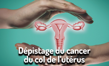 Cancer du Col de l'utérus